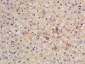 CES1/Liver Carboxylesterase 1 Polyclonal Antibody